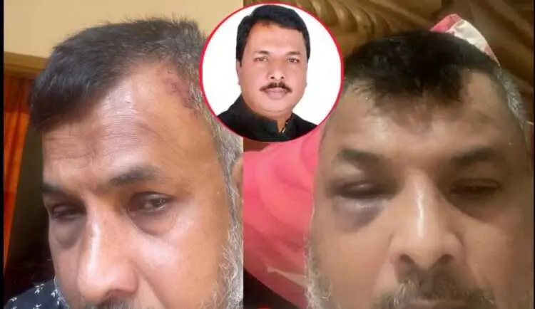 বড়লেখা উপজেলার সাবেক চেয়ারম্যান সোয়েব আহমদের ওপর হামলা বড়লেখার সাবেক উপজেলা চেয়ারম্যান সোয়েব আহমদের